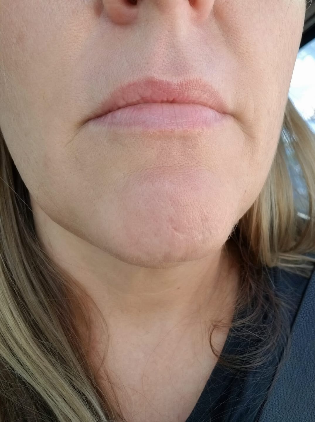 Customer photo review of Huile anti-repousse à la racine