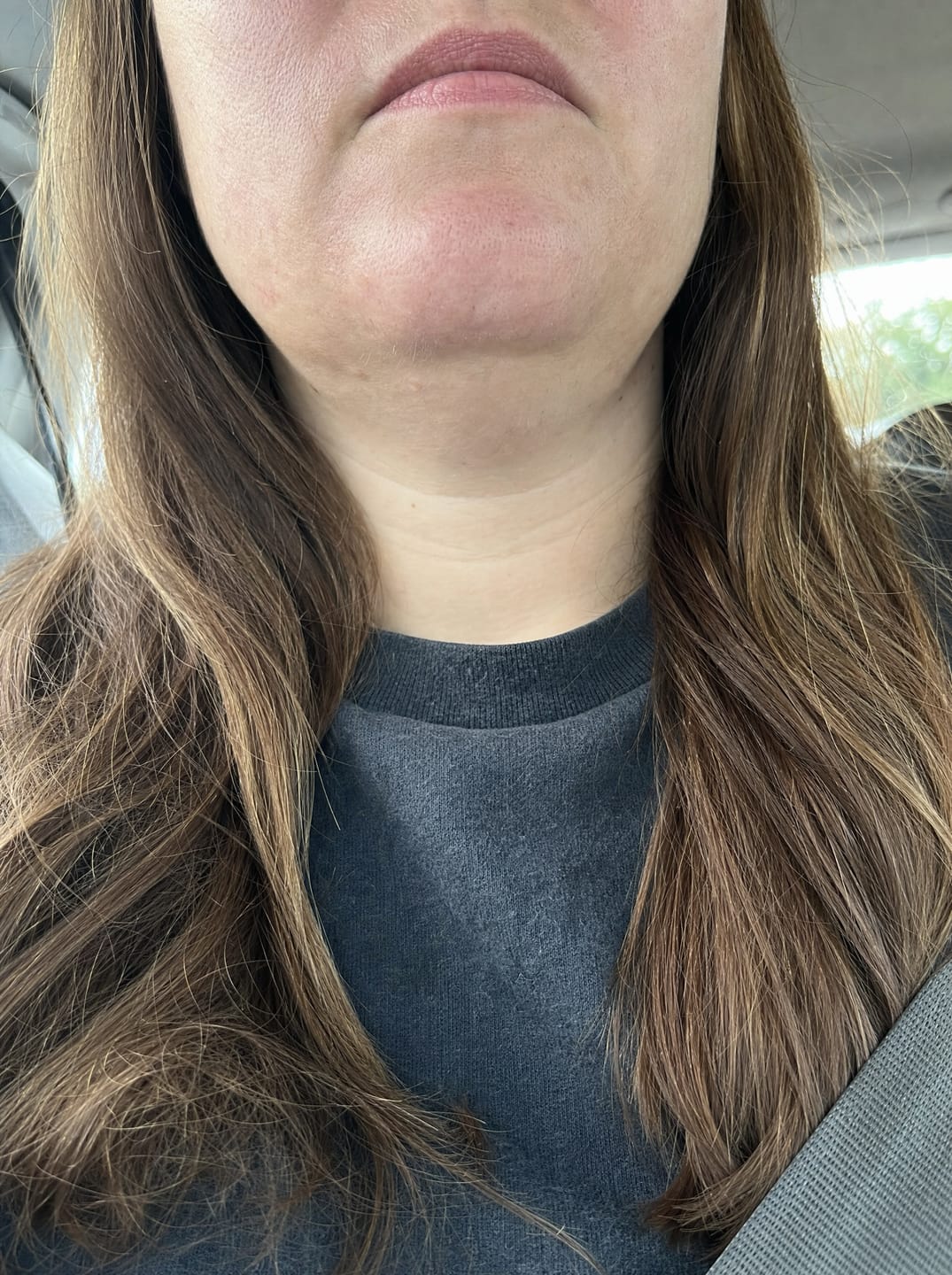 Customer photo review of Huile anti-repousse à la racine
