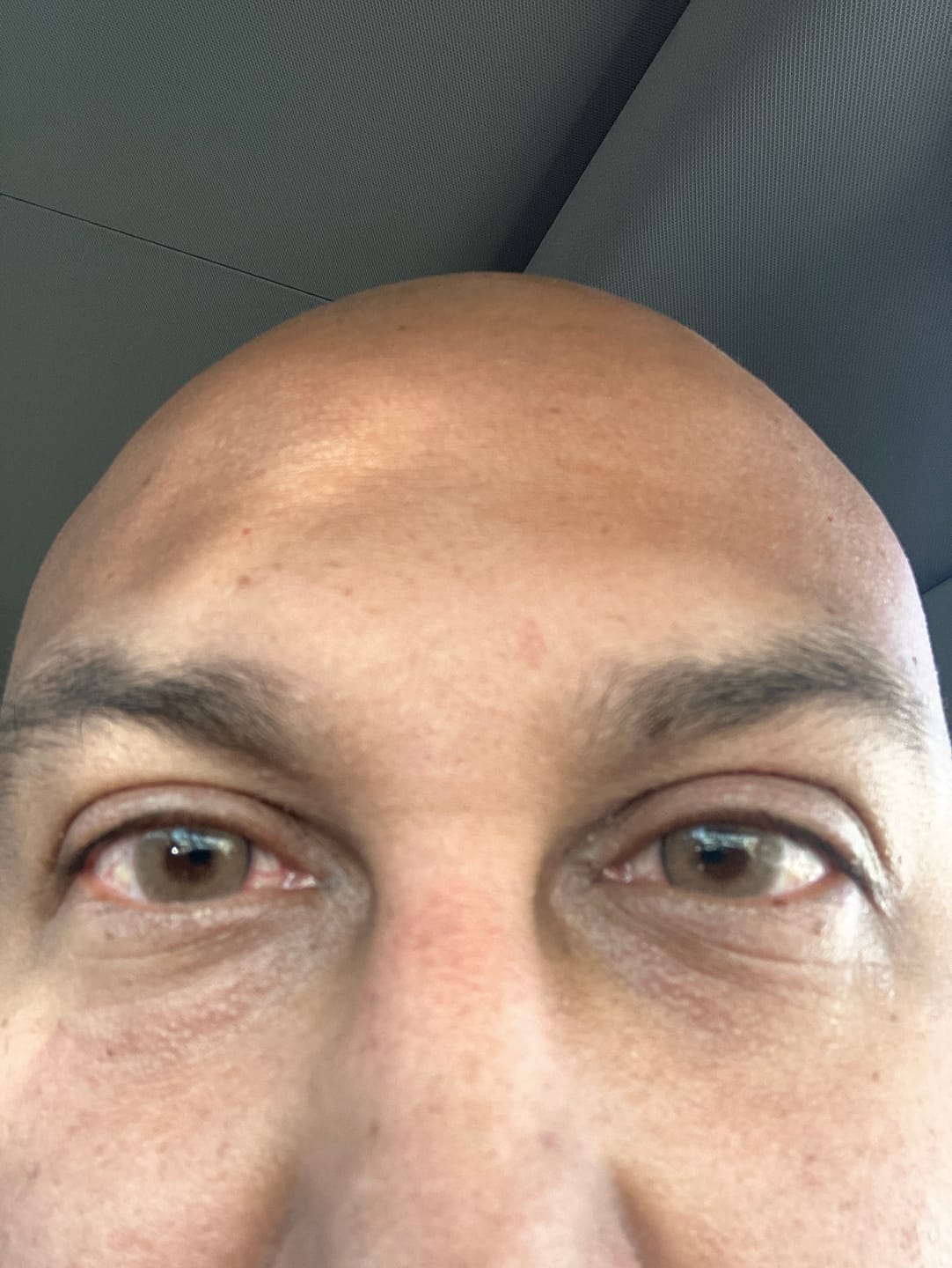 Customer photo review of Wild Honey Contact Lenses