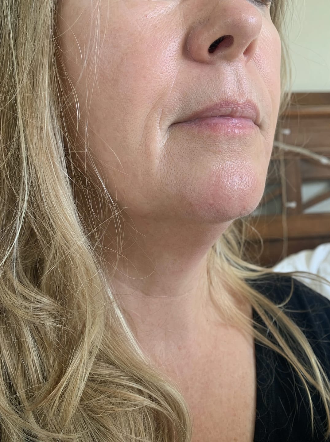 Customer photo review of Huile anti-repousse à la racine