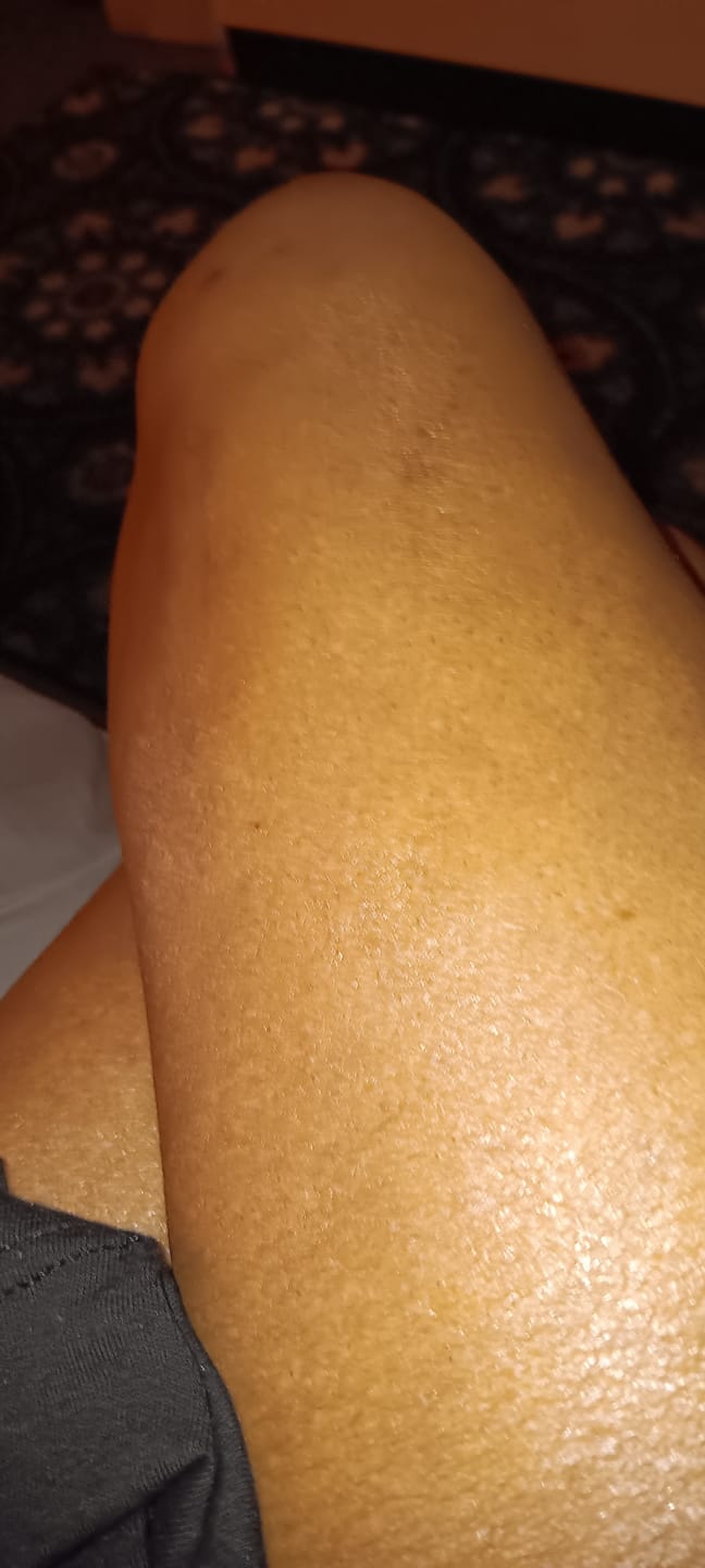 Customer photo review of BODY GLAZE: BILLION DOLLAR BABY