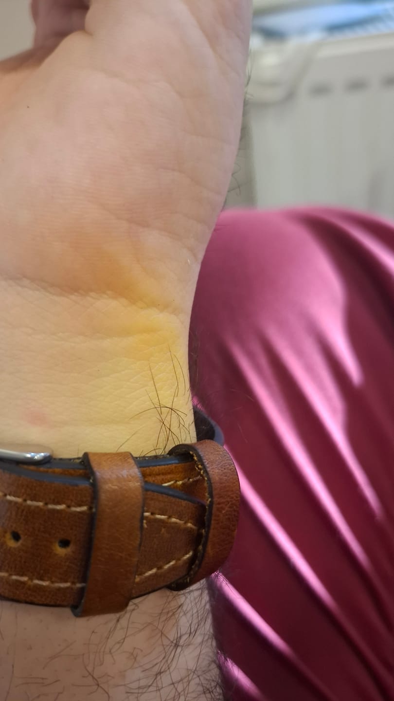 Customer photo review of Samsung Watch Deri Kordon Hardal - Buttero