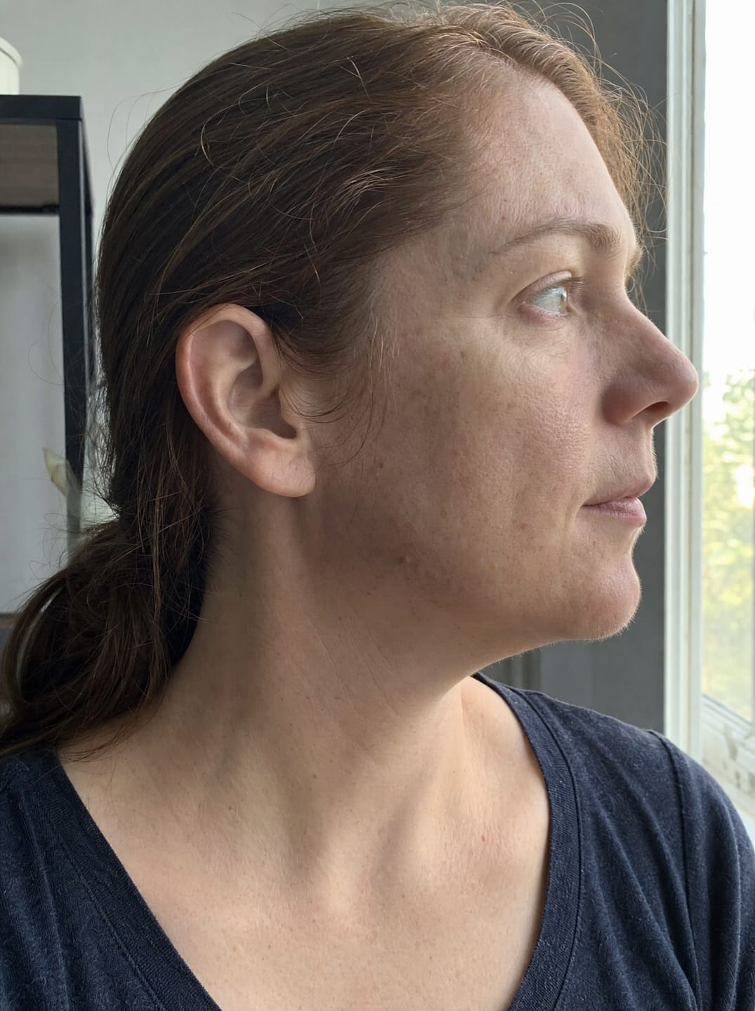 Customer photo review of Huile anti-repousse à la racine