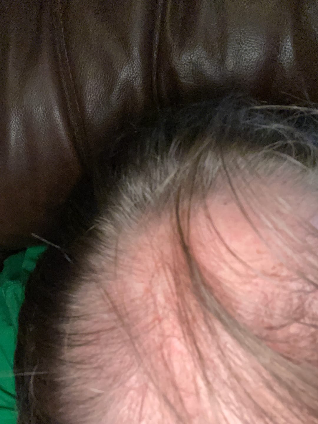 Customer photo review of Spartan™ Root Activator Shampoo 3 Bottles(sc)