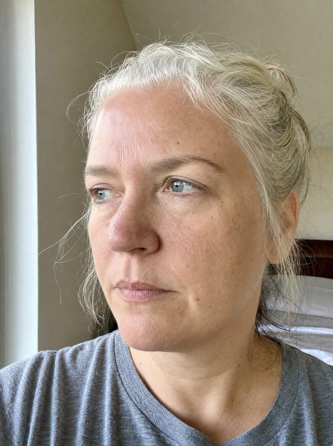 Customer photo review of Huile anti-repousse à la racine