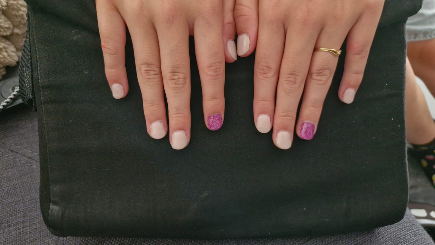 Customer photo review of Glowdip Alles-in-één Manicure Set