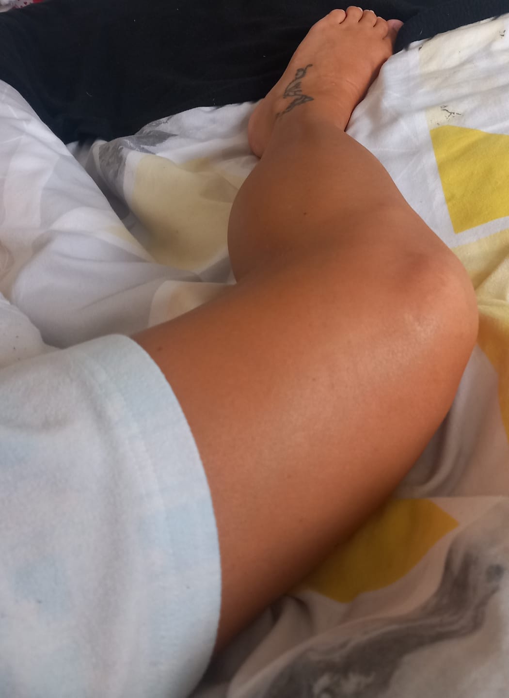 Customer photo review of Intensifying Tanning Gel - Coconut
