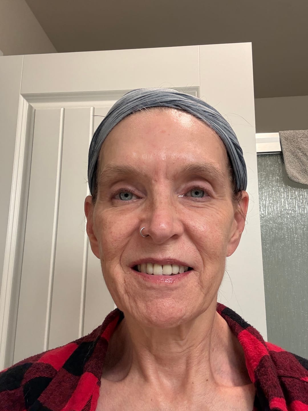 Customer photo review of Koriderm | time reverse: crema todo en uno
