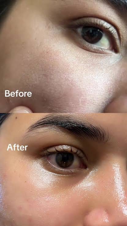 Customer photo review of Arvente Retinal Renewal™