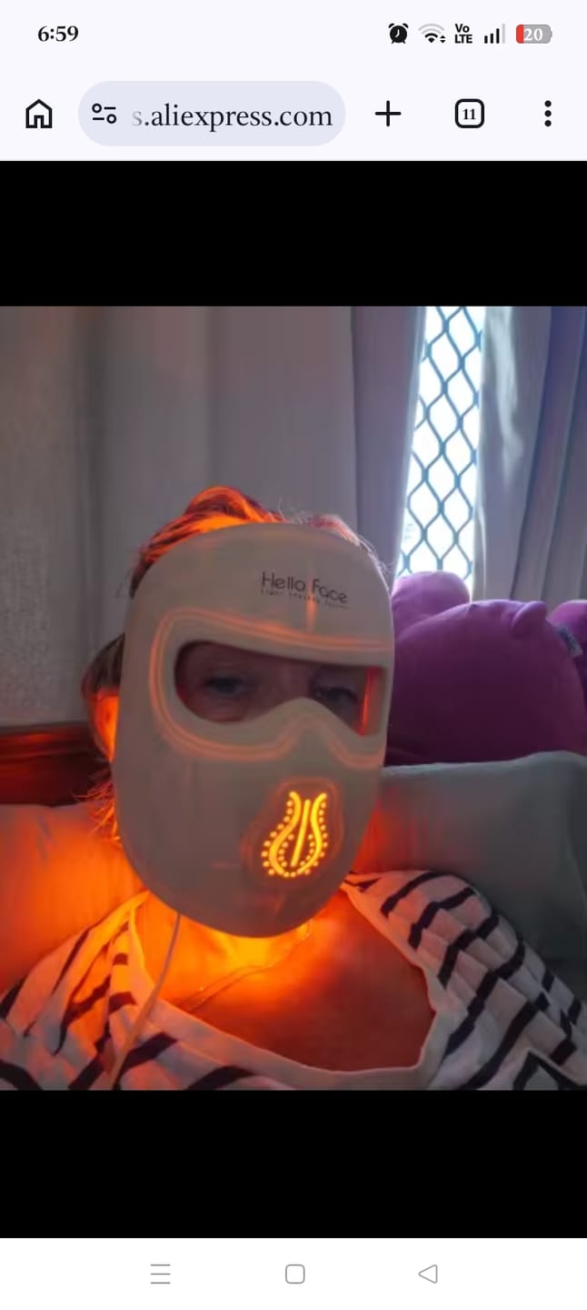 Customer photo review of M300 LED Face Mask - 311 LED Anti-Aging &amp; Acne Light Therapy