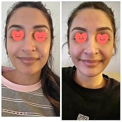 Customer photo review of Arvente Retinal Renewal™
