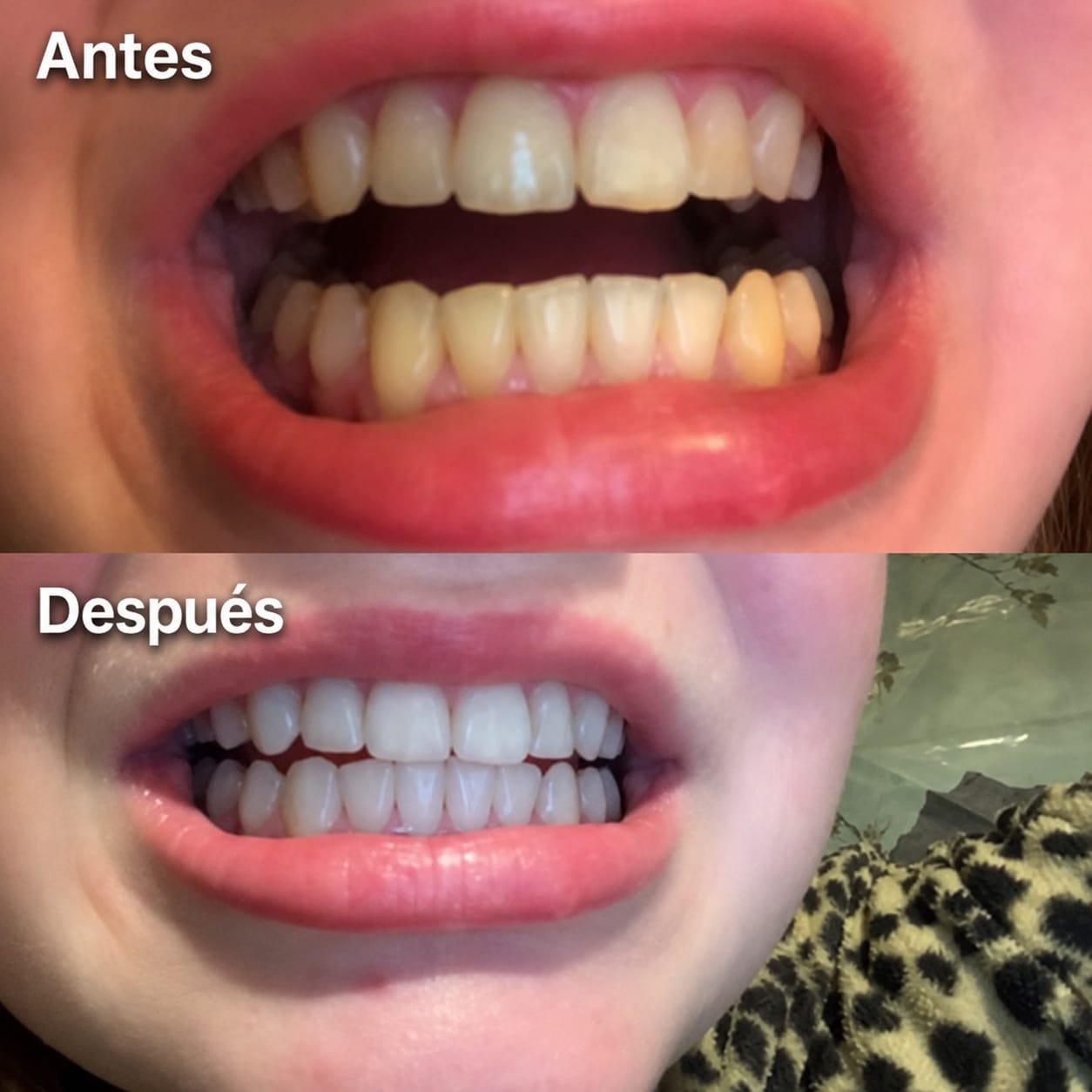 Customer photo review of Enjuague Bucal Morado