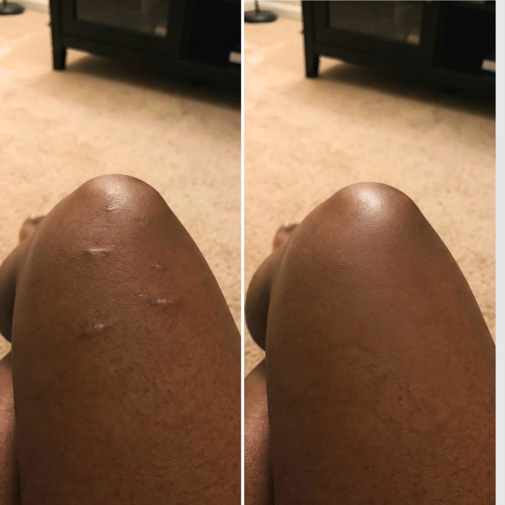 Customer photo review of Body Coverage Perfector