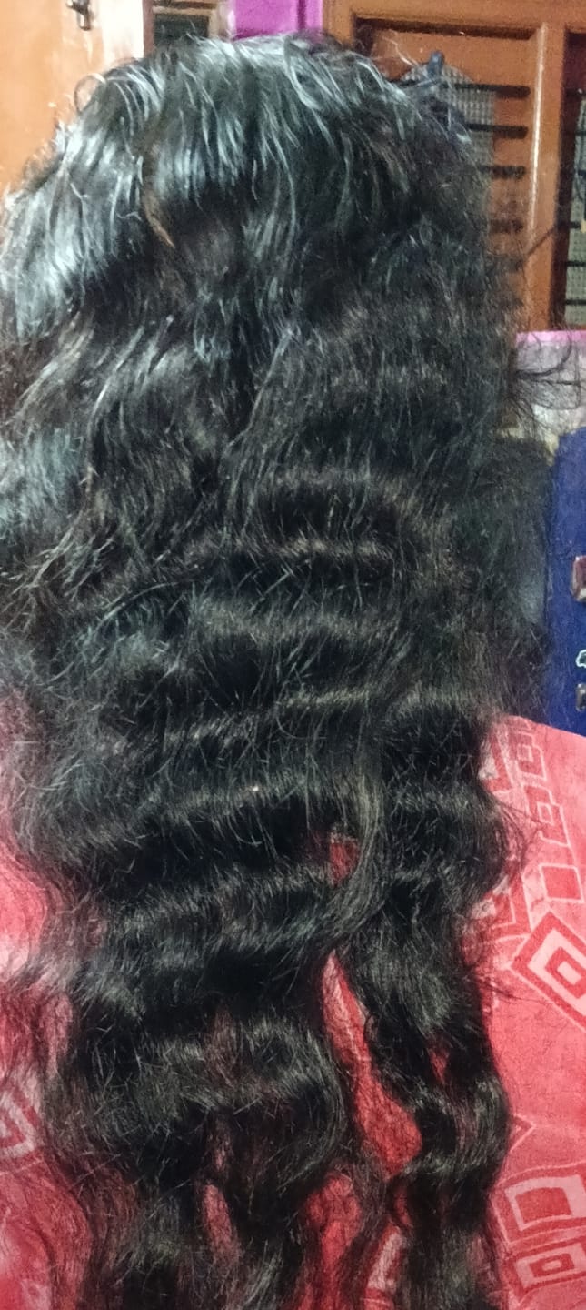 Customer photo review of Advance Hair Growth Serum 2.0 (30ml)