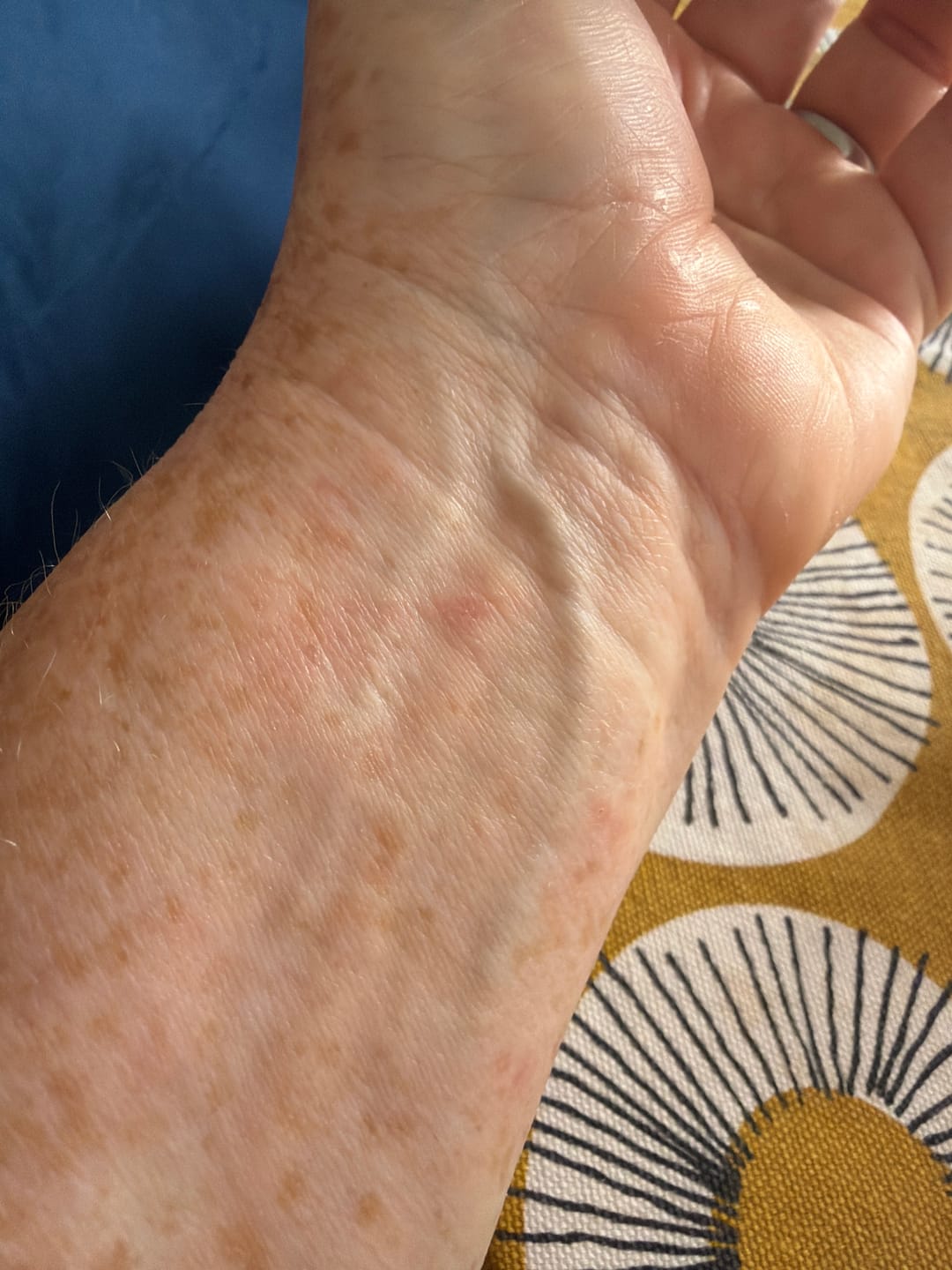 Customer photo review of Diamond Clover Strap for Apple Watch