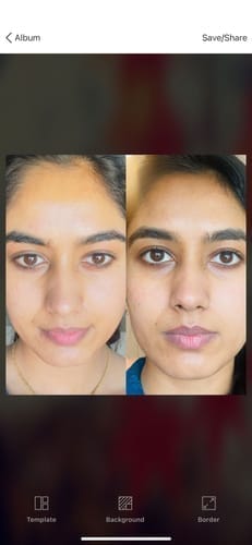 Customer photo review of Eyephalt Eyebag Cream
