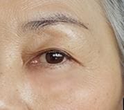 Customer photo review of Eyephalt Eyebag Cream