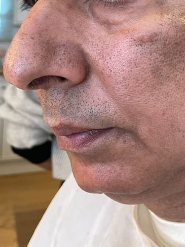 Customer photo review of Peel Shot Glow Black Rice Ampoule