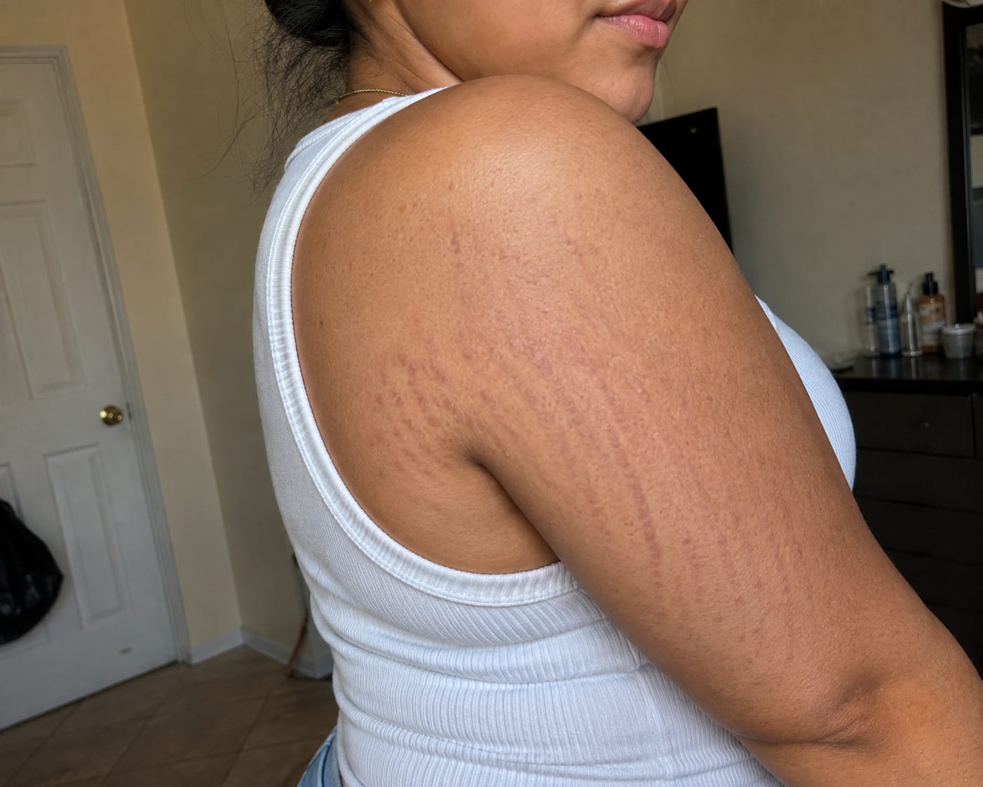 Customer photo review of Skin Restoration