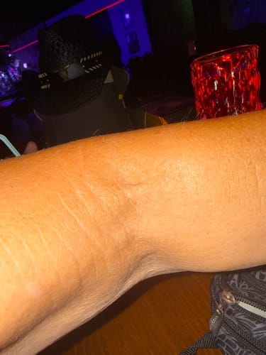 Customer photo review of Botanical Body Oil™