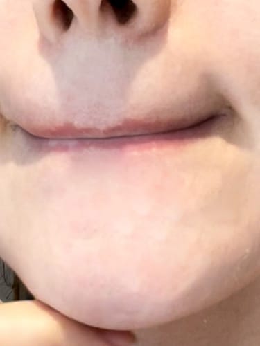 Customer photo review of Peel Shot Glow Black Rice Ampoule