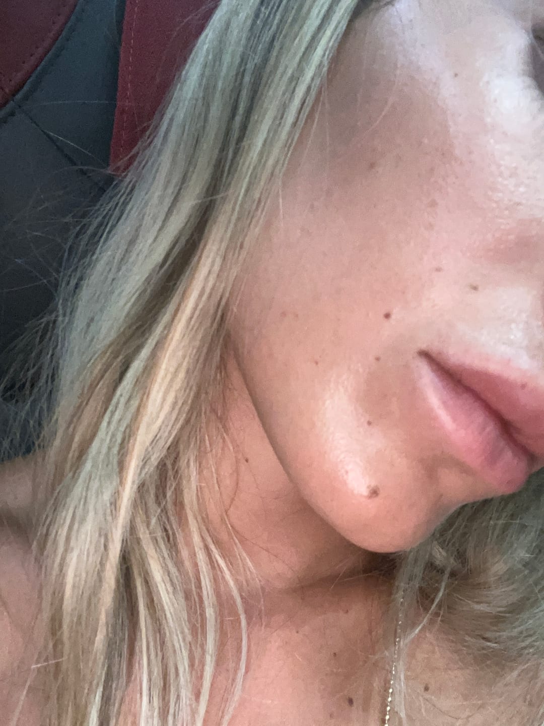 Customer photo review of BioChroma – Siero Coreano Effetto Lifting dalla Prima Applicazione