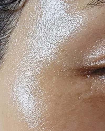 Customer photo review of Cemenrete Eye care Line