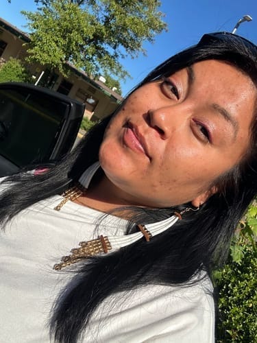 Customer photo review of Peel Shot Glow Black Rice Ampoule