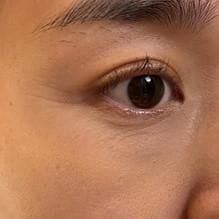 Customer photo review of Cemenrete Eye care Line
