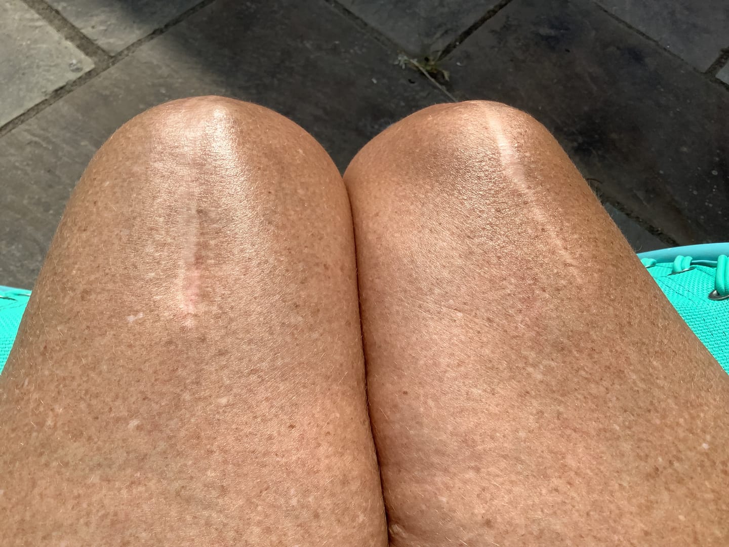 Customer photo review of Body For Us Anti-Cellulite Massage Oil