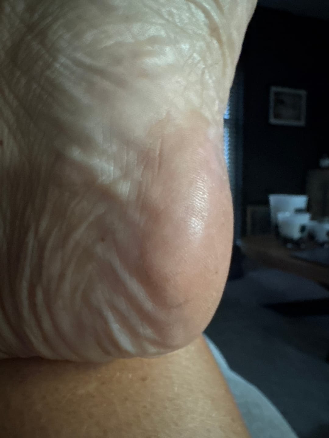 Customer photo review of ✨ HoneyGlow™ – Kit Beauté Pieds