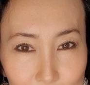 Customer photo review of Eyephalt Eyebag Cream