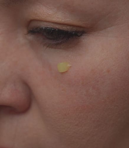 Customer photo review of Retinol Eyebag Cream