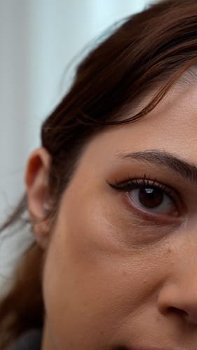 Customer photo review of Retinol Eyebag Cream