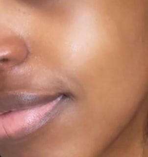 Customer photo review of Peel Shot Glow Black Rice Ampoule