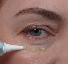 Customer photo review of Retinol Eyebag Cream