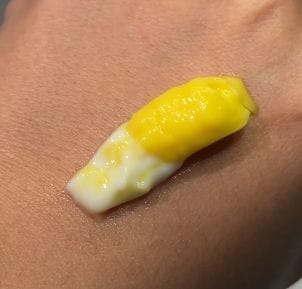 Customer photo review of TX Retinalsome Double Effect Eyecream