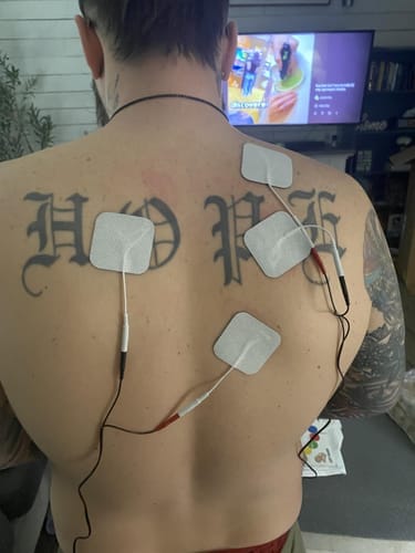 Customer photo review of TENS Elektrostimulationsgerät StimPulse