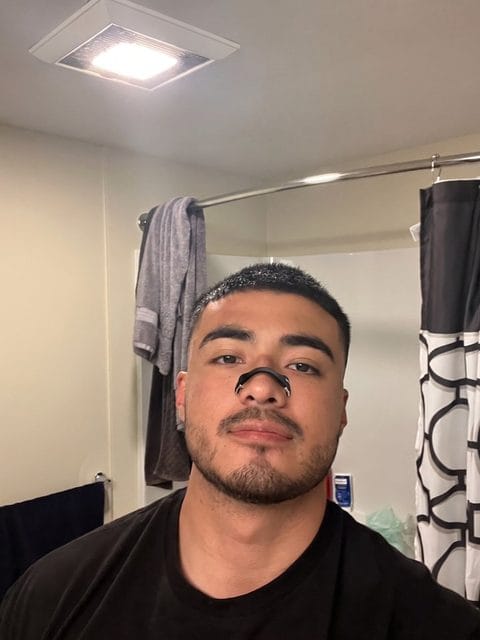 Customer photo review of Oxia — Kit Dilatador Nasal Magnético