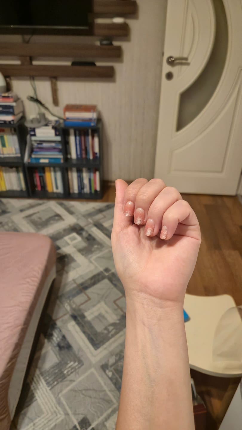 Customer photo review of N Beginning Jel Tırnak 30 Adet, 2 Kullanım