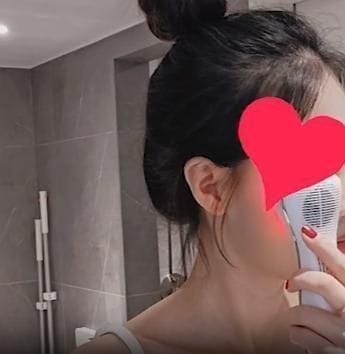 Customer photo review of EX Derma Booster Sonic Shot