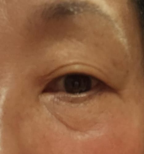Customer photo review of Cemenrete Eye care Line