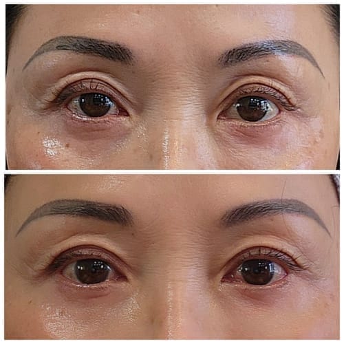 Customer photo review of Cemenrete Eye care Line