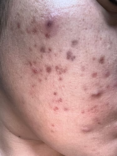 Customer photo review of TX Cream