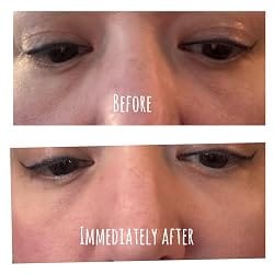 Customer photo review of EyeLift™ Repair Cream