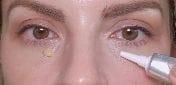 Customer photo review of Retinol Eyebag Cream