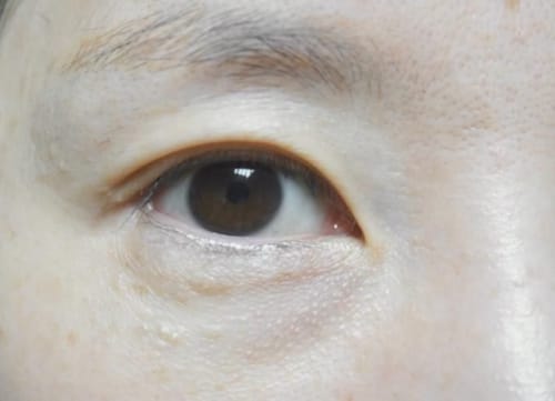 Customer photo review of Cemenrete Eye care Line