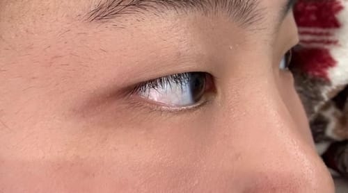 Customer photo review of EX Derma Booster Sonic Shot