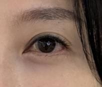 Customer photo review of EX Derma Booster Sonic Shot
