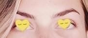 Customer photo review of Eyephalt Eyebag Cream